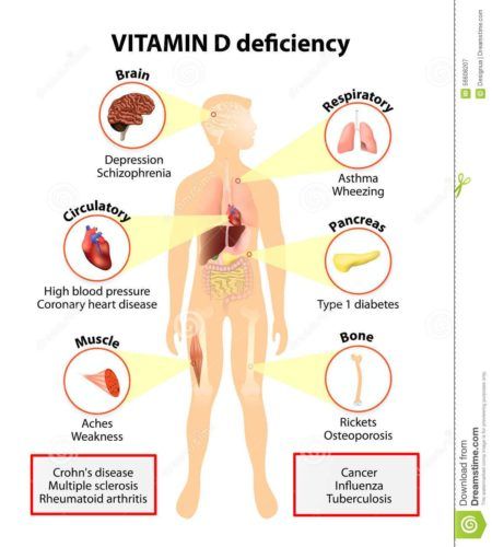 deficiência de vitamina D como é causada