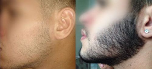 crescer barba antes e depois